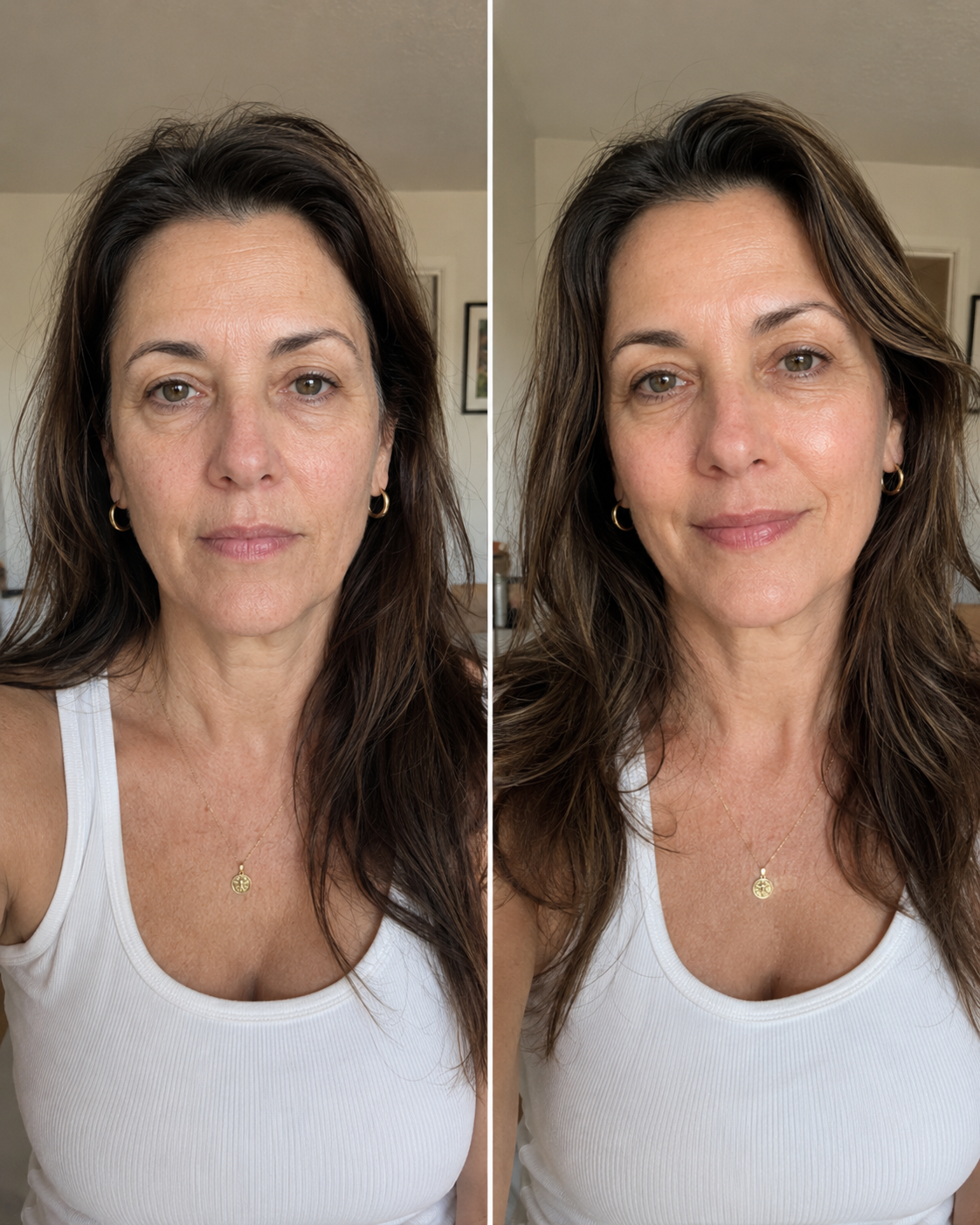 Antes / Después — drenaje facial cosmético