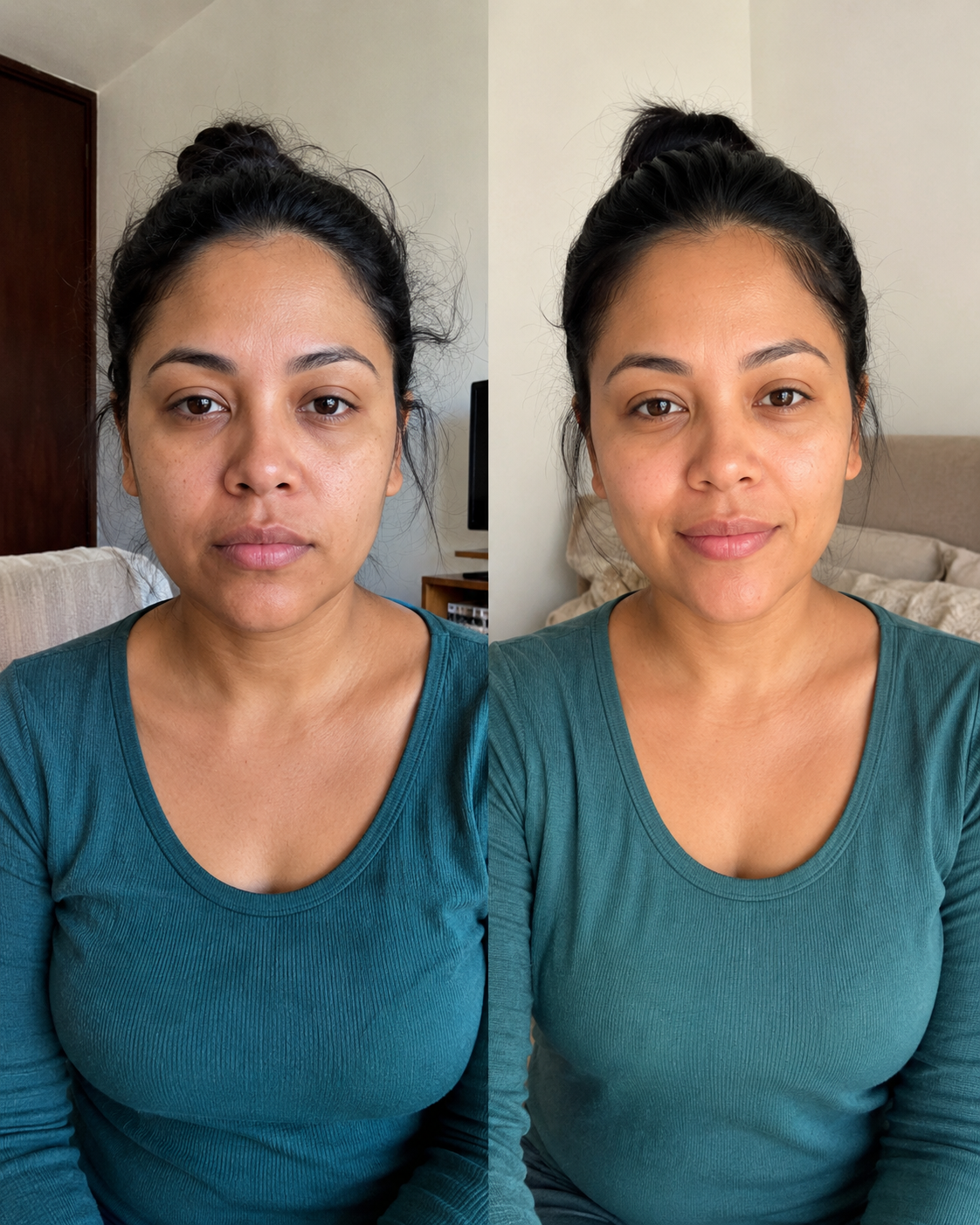 Antes / Después — drenaje facial cosmético